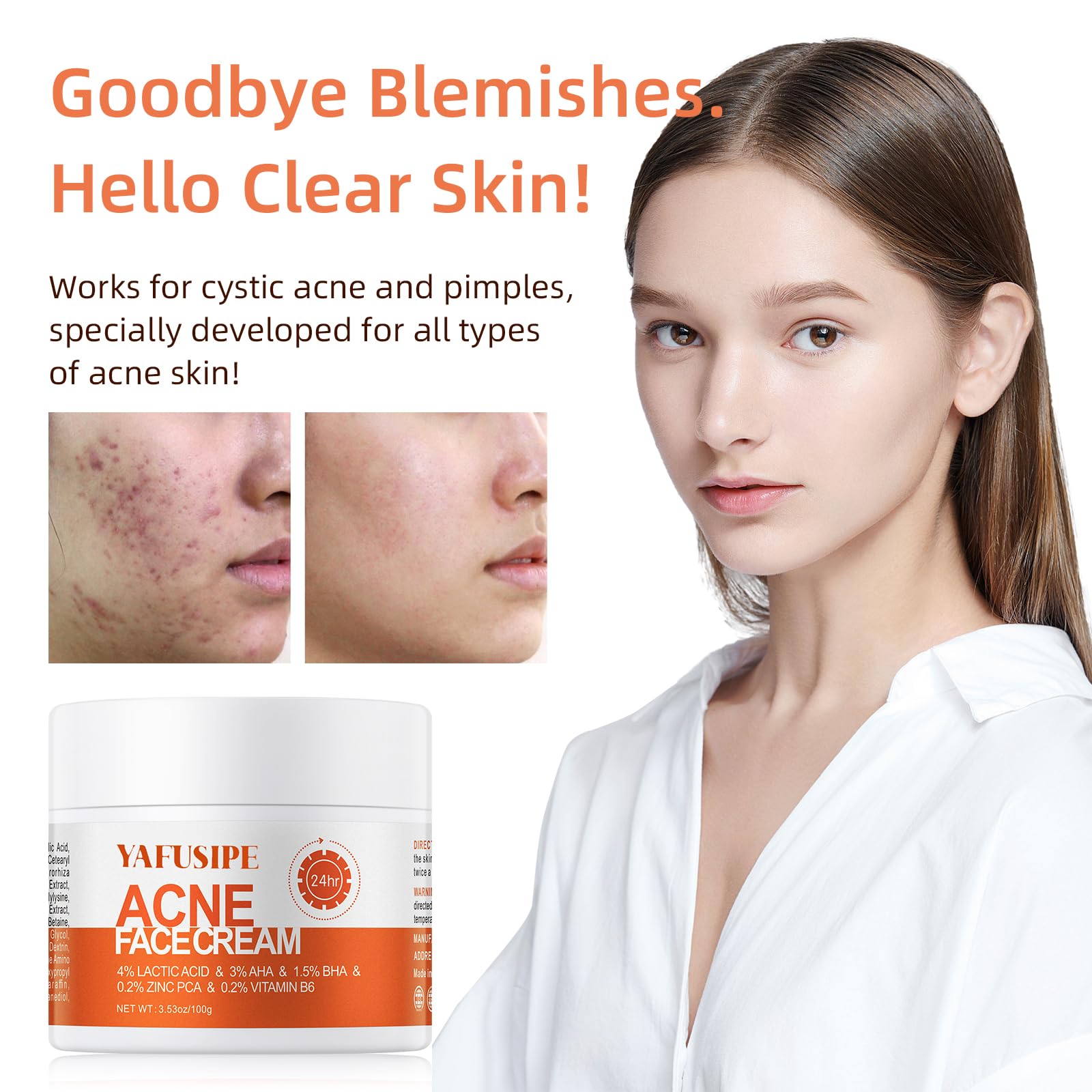 YAFUSIPE Crème acne pores visage pour pores plus nets.