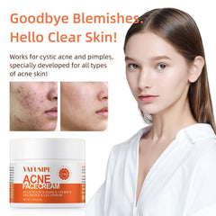 YAFUSIPE Crème acne pores visage pour pores plus nets.