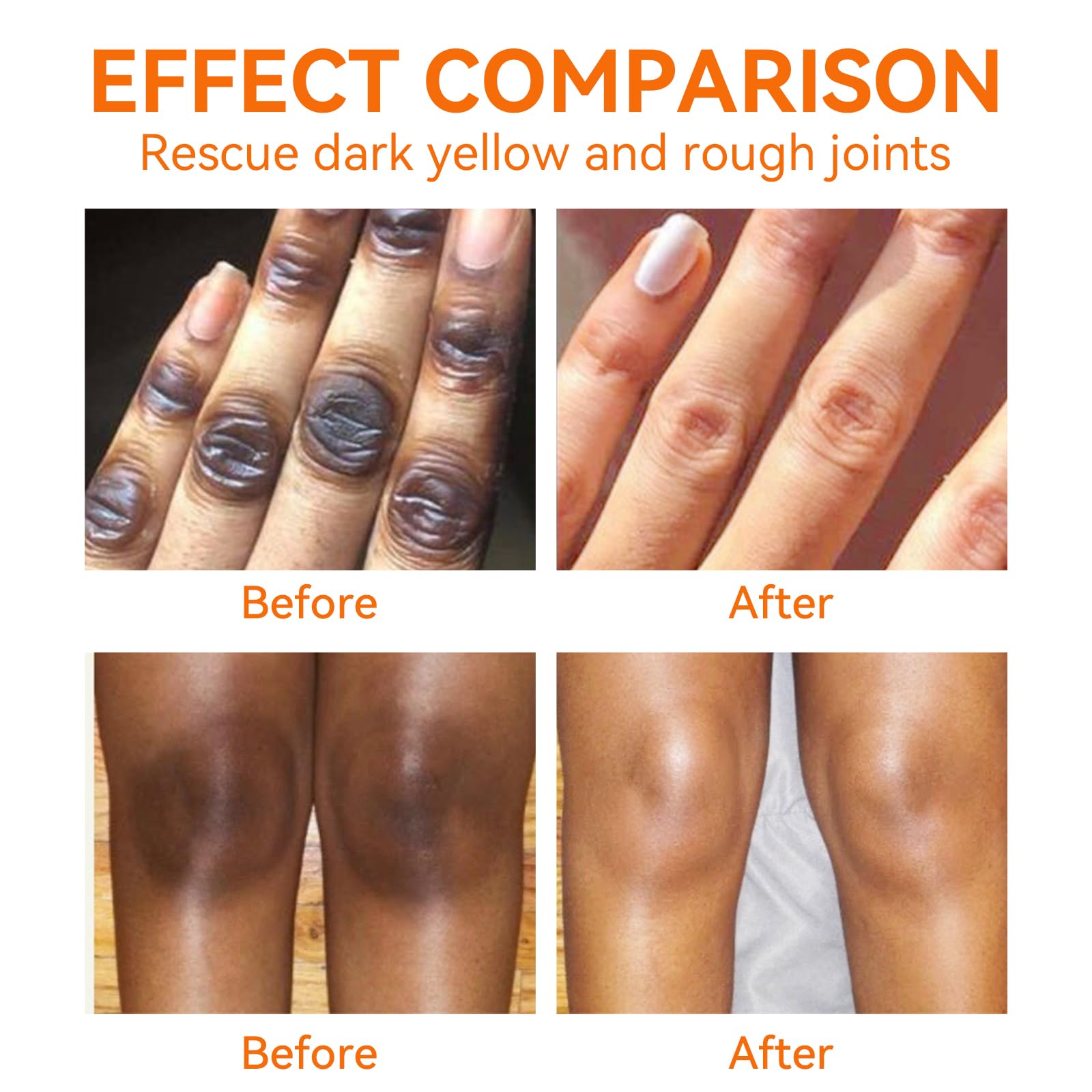 Crème YAFUSIPE pour coudes sombres, texture riche qui apaise et adoucit.