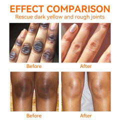 Crème YAFUSIPE pour coudes sombres, texture riche qui apaise et adoucit.