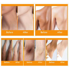 Crème YAFUSIPE pour genoux sombres, hydrate en profondeur et lisse.