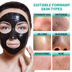 Kit d'outils d'extraction des pores noirs YAFUSIPE inclus