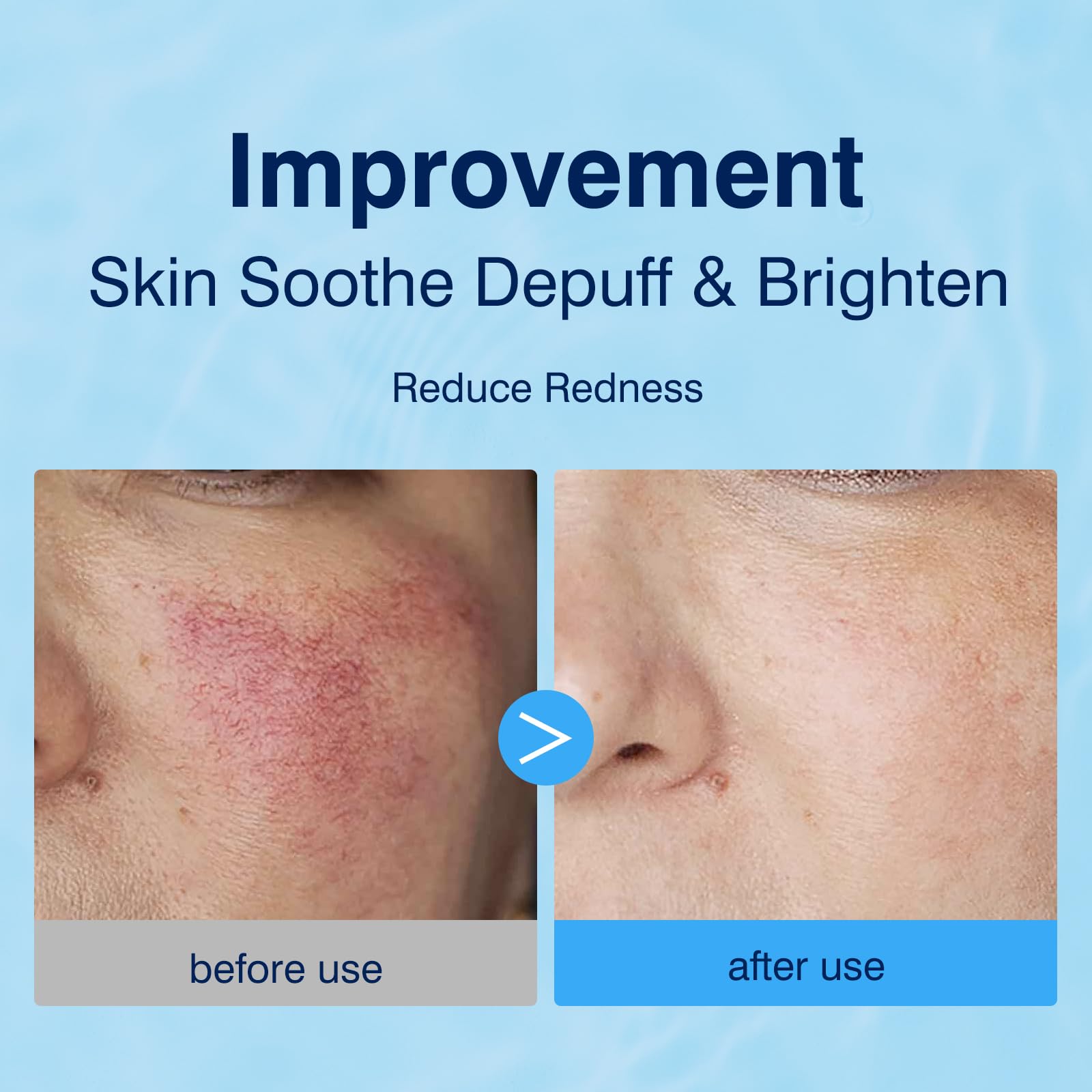 Pad tonifiant YAFUSIPE pour l’application visage et une peau lumineuse