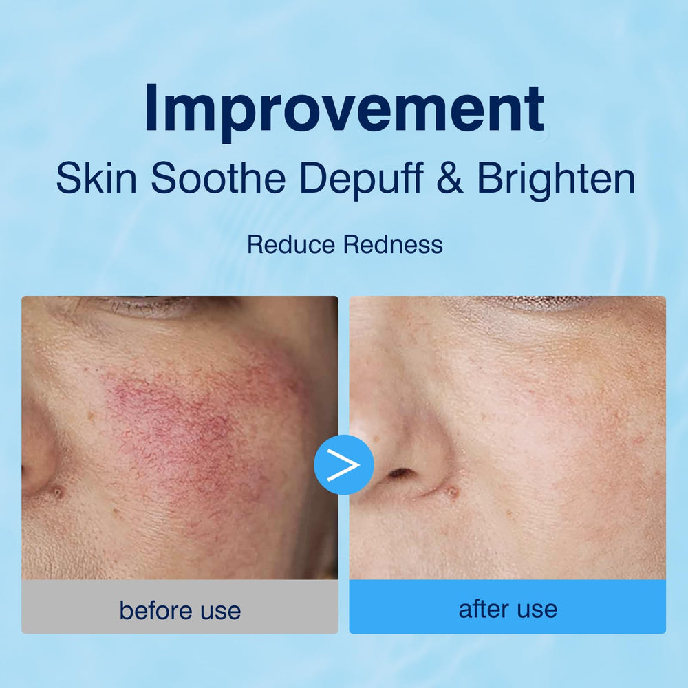 Pad tonifiant YAFUSIPE pour l’application visage et une peau lumineuse