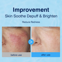 Pad tonifiant YAFUSIPE pour l’application visage et une peau lumineuse