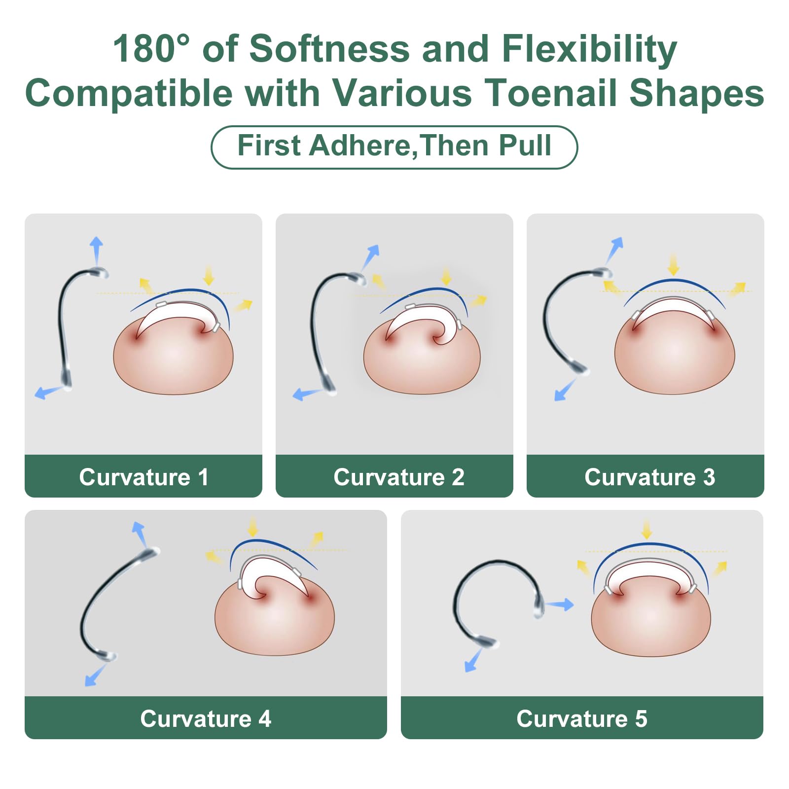Yanxifei correction-double-fil, correction efficace pour ongles épaissis et profondément incarnés.