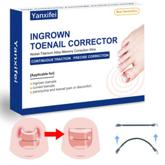 Yanxifei Correcteur Nitinol avant utilisation pour soulager l’ongle incarné