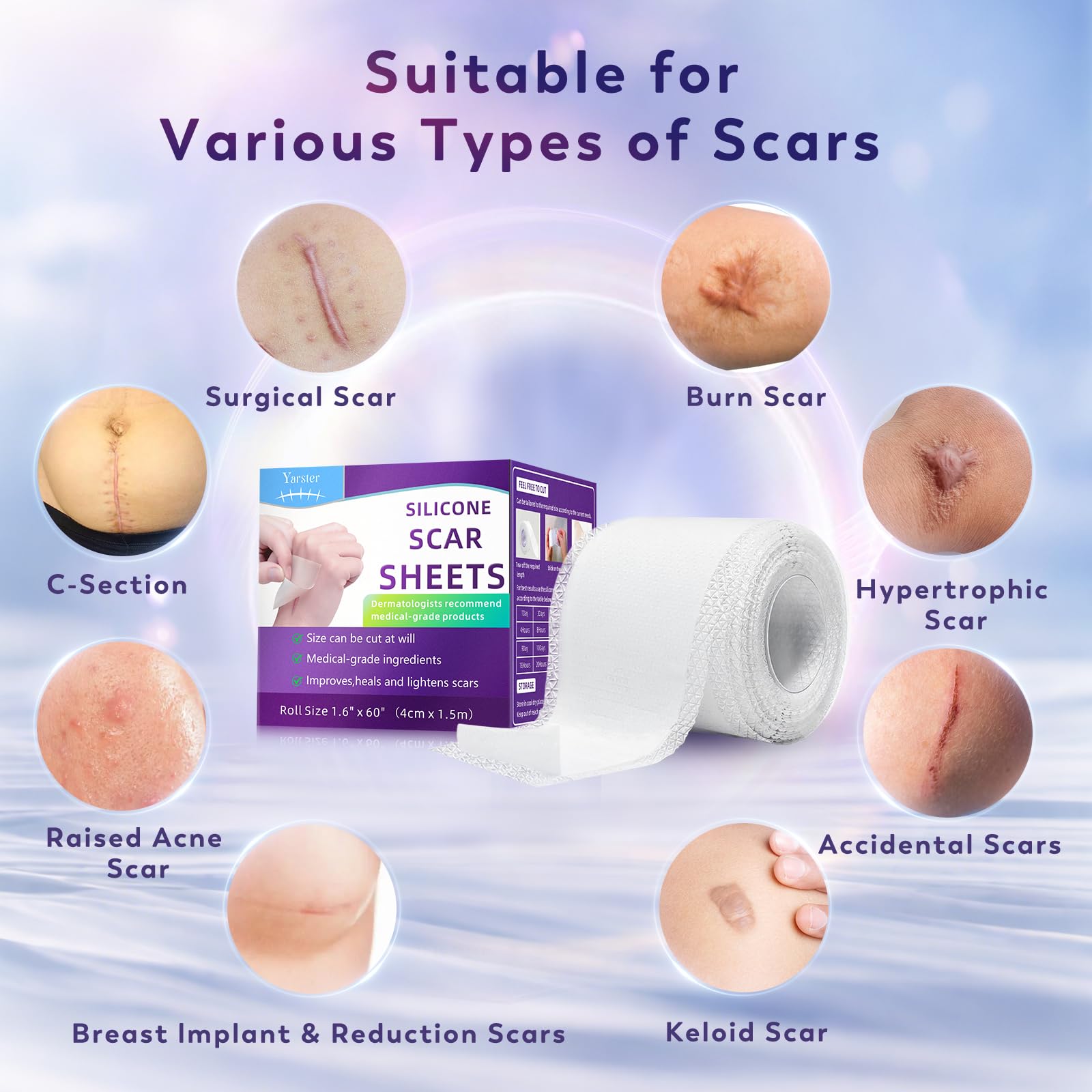 Yarster – bande silicone brulure: protection continue et réduction visuelle possible
