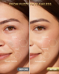 YeCheer Dermaplane Systeme Sonique Dermaplaning: exfoliation plus efficace grâce aux vibrations.