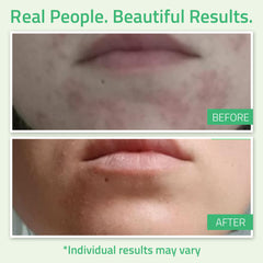Bouteille YEOUTH de 2 oz prête à une exfoliation mensuelle.