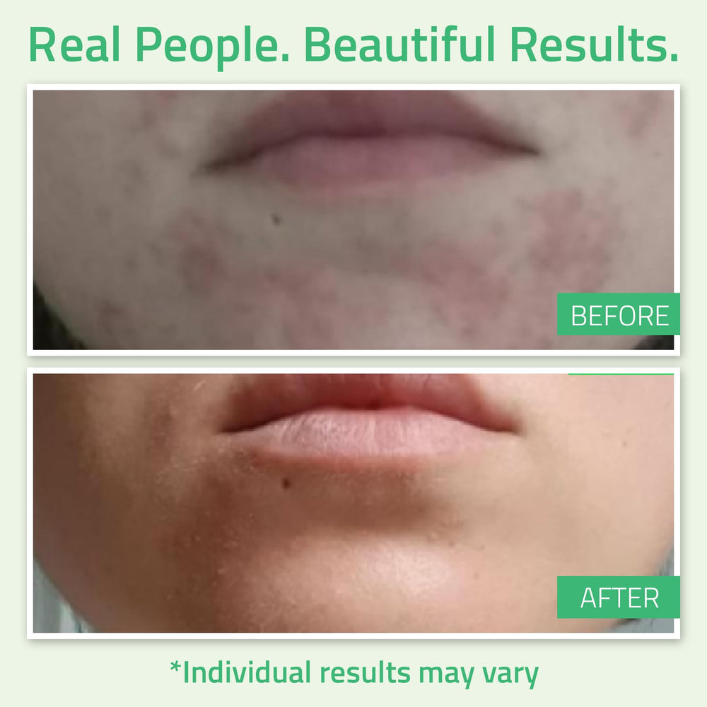Texture gel exfoliant YEOUTH Glycolic Peel pour peau soyeuse