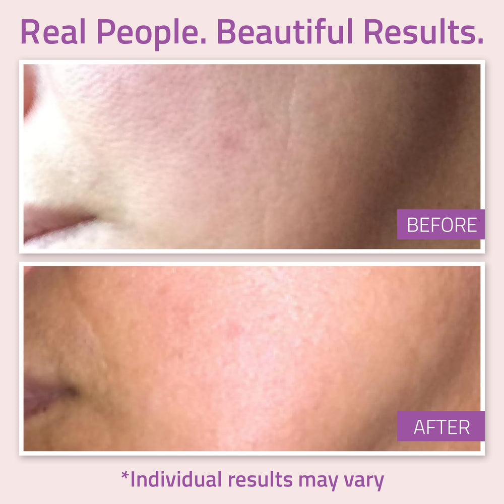 YEOUTH sérum nuit visage, application douce avant le coucher.