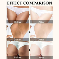 Yeweian Crème Clarifiante Zones Intimes: hydratation et teinte plus uniforme.