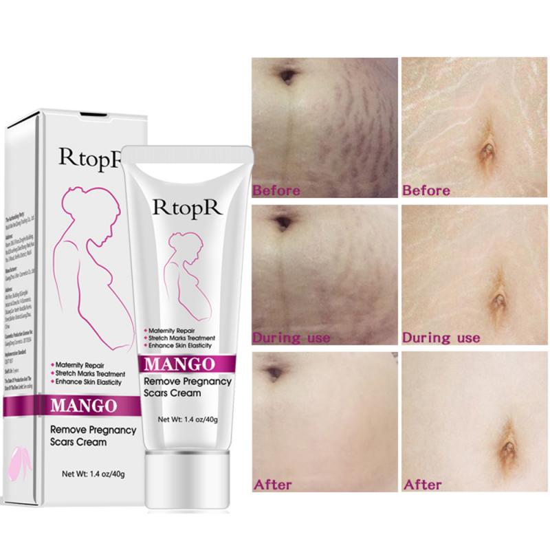 YG LianKai Mango – sans parfum : soin doux pour peaux sensibles