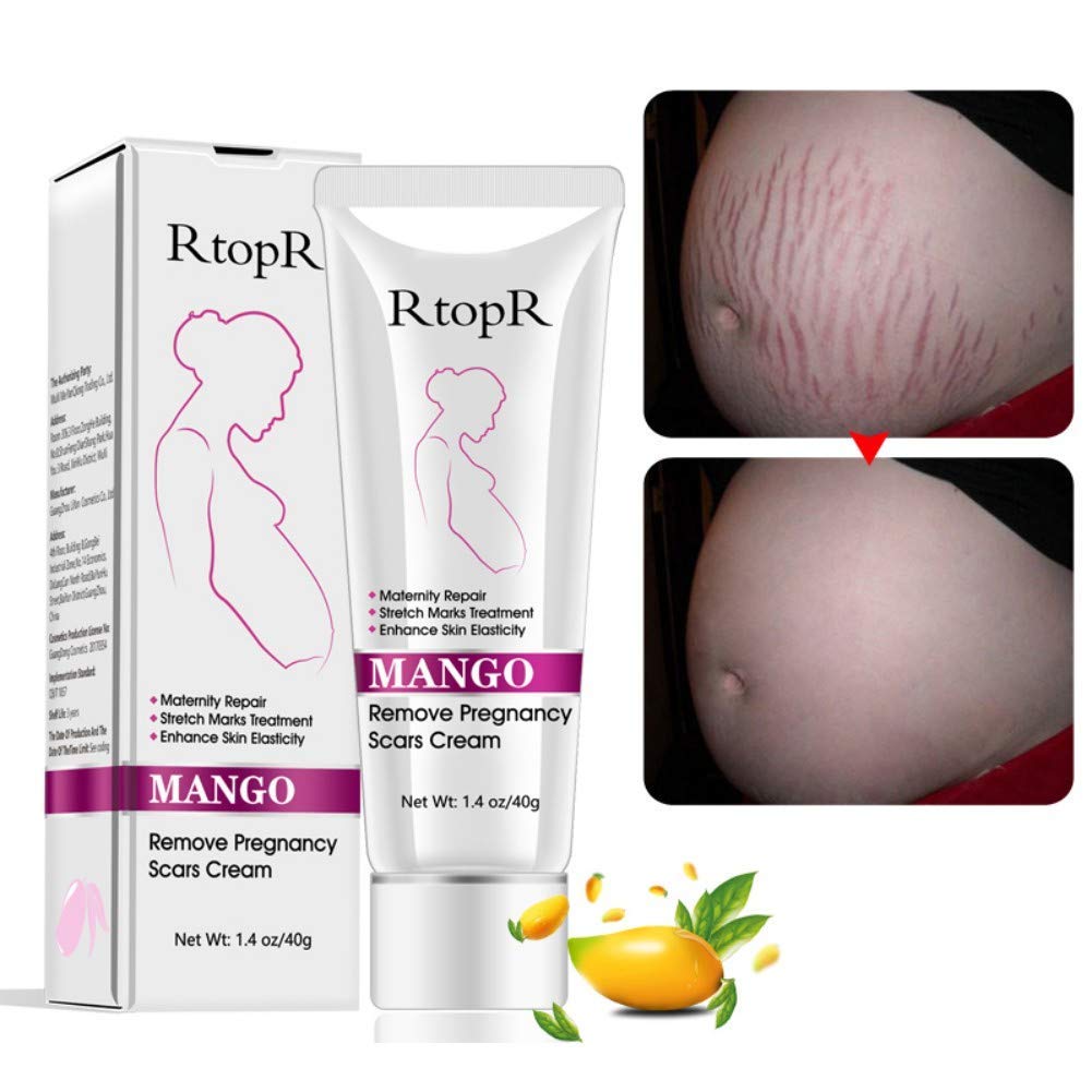 YG LianKai Mango – vergetures : peau hydratée et lisse après application
