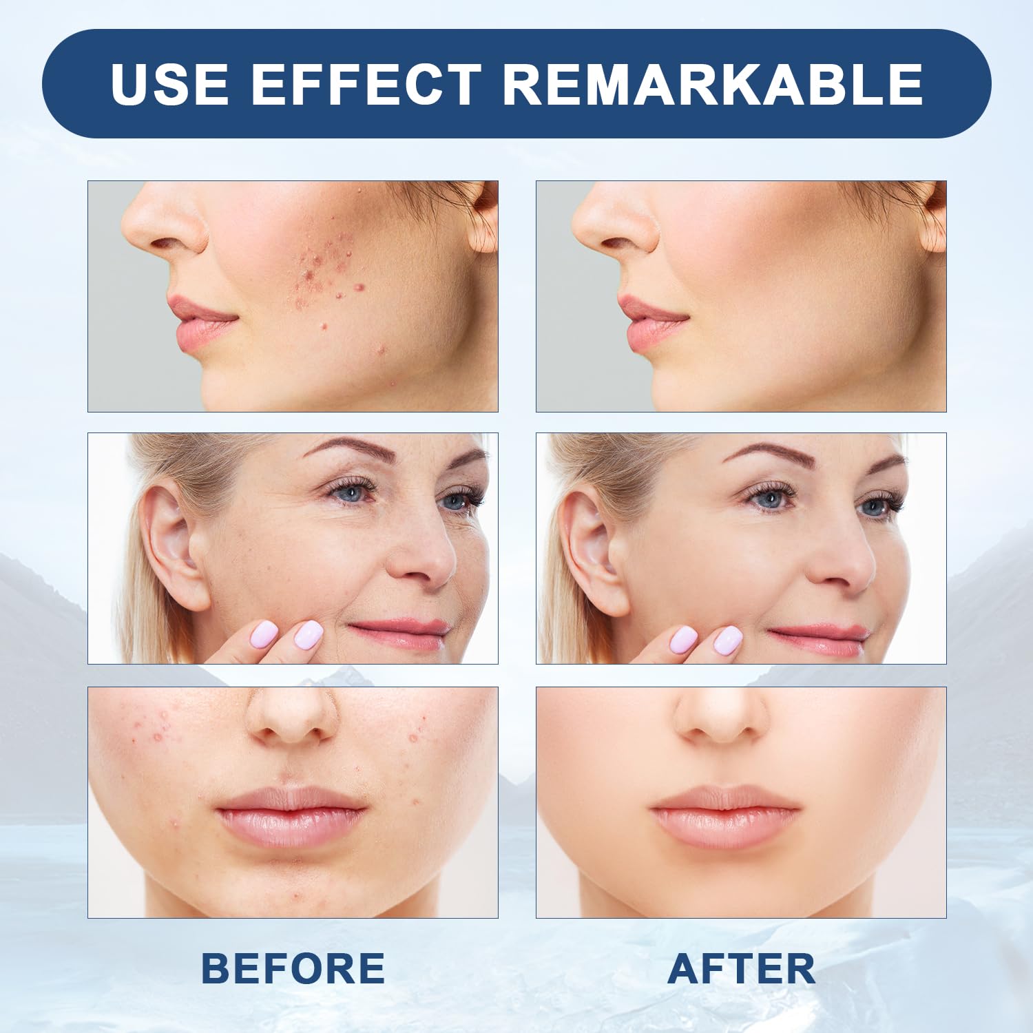 Lot de 3 sérums Yicengy visage prêt à booster votre routine.