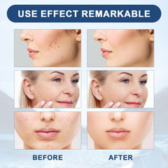 Lot de 3 sérums Yicengy visage prêt à booster votre routine.
