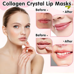 Masques lèvres Yihurlm hydratation intense et amélioration douceur.