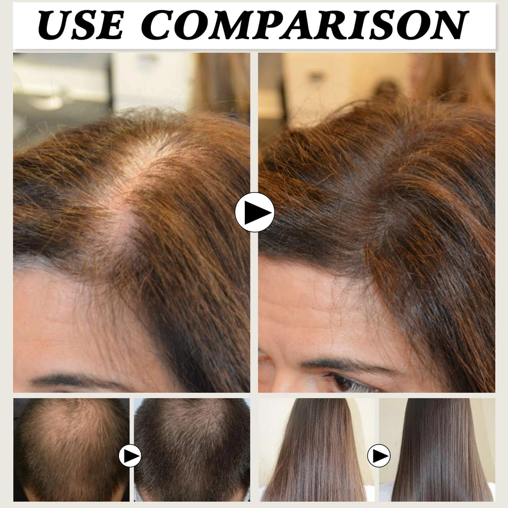 Application sur cuir chevelu avec le gel Deoxyribose YIVANNUO pour nourrir.