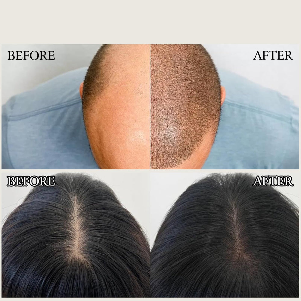 Routine quotidienne avec le gel YIVANNUO Deoxyribose pour cheveux.