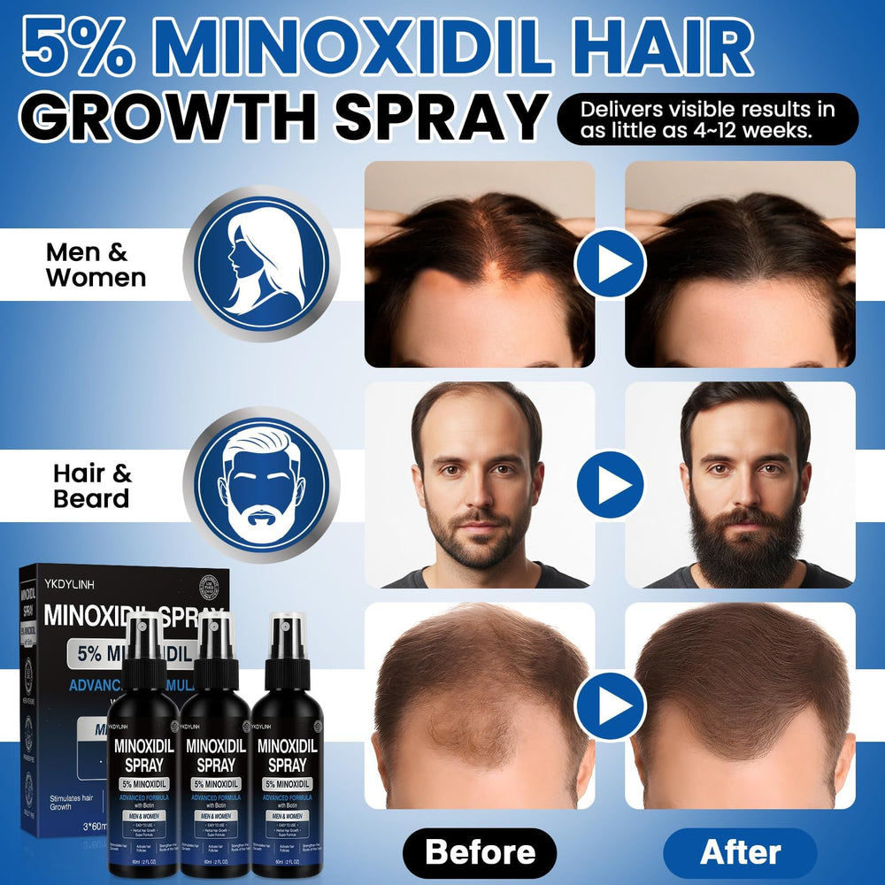 YKDYLINH Minoxidil Spray: massage du cuir chevelu pour absorption efficace.