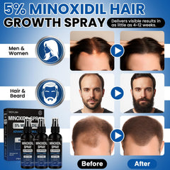 YKDYLINH Minoxidil Spray: massage du cuir chevelu pour absorption efficace.