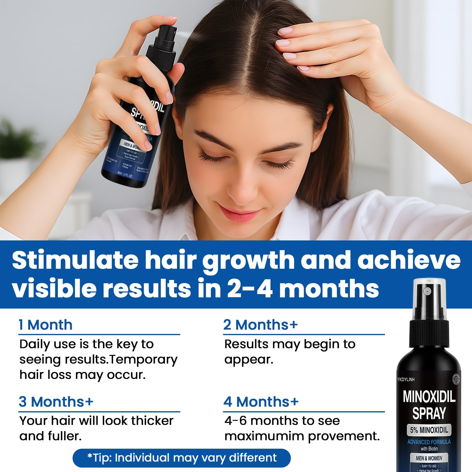 YKDYLINH Minoxidil Spray: effet potentiel sur la densité des cheveux.
