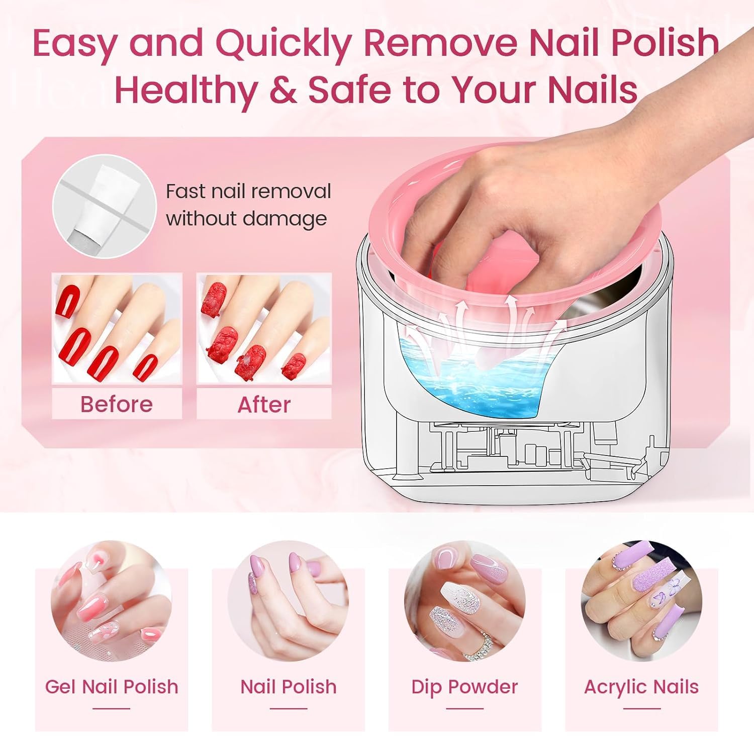 Yokilly kit d’extraction d’ongles 10 pièces utile au salon ou à la maison.
