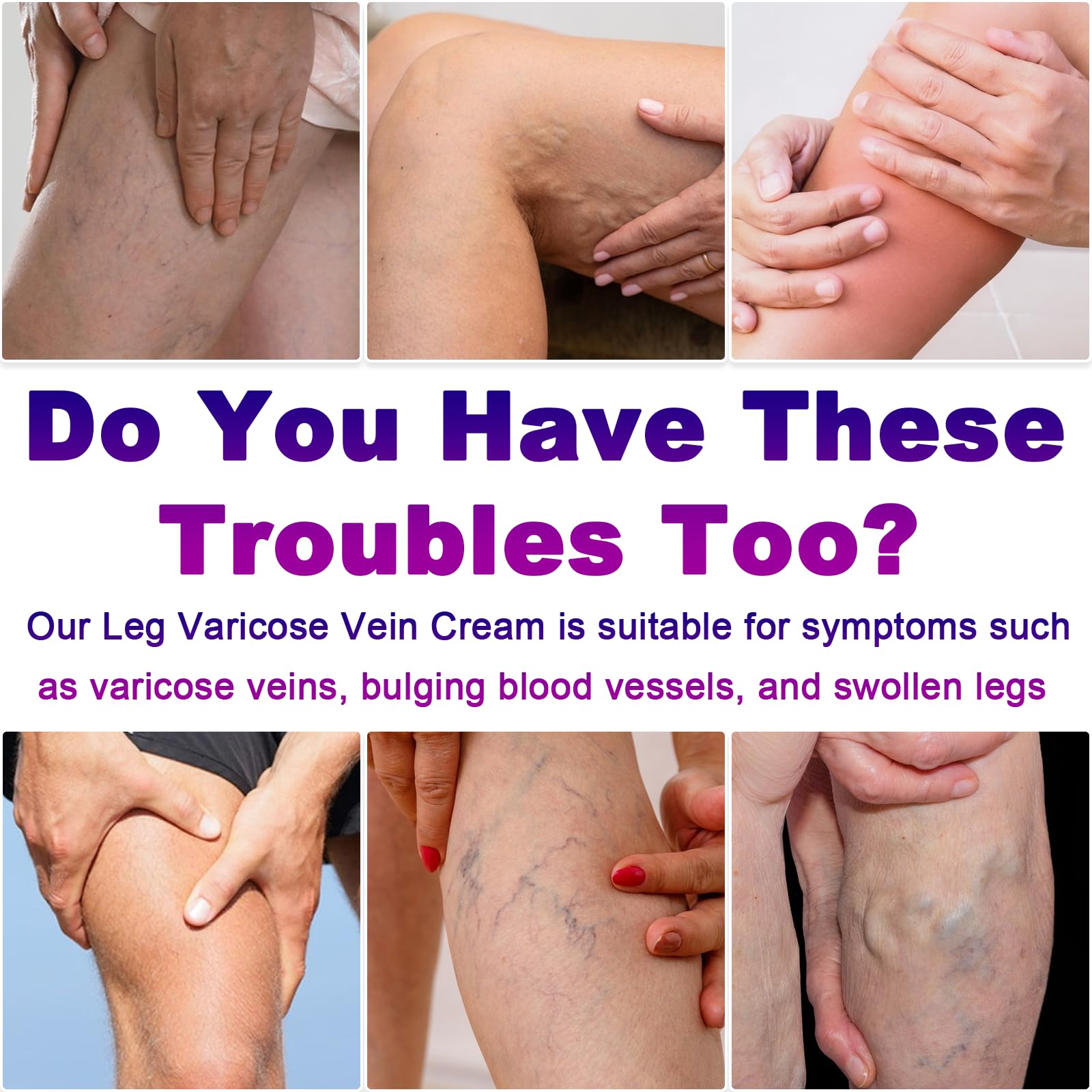 Application de Yongsenina Varices sur les jambes pour un soulagement doux.