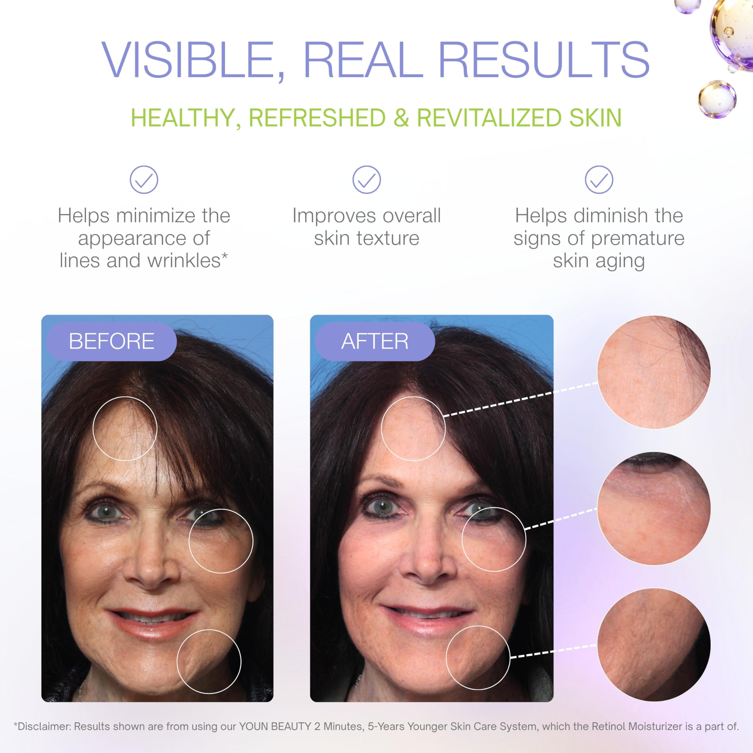 Avec YOUN Beauty, effet éclat au réveil.