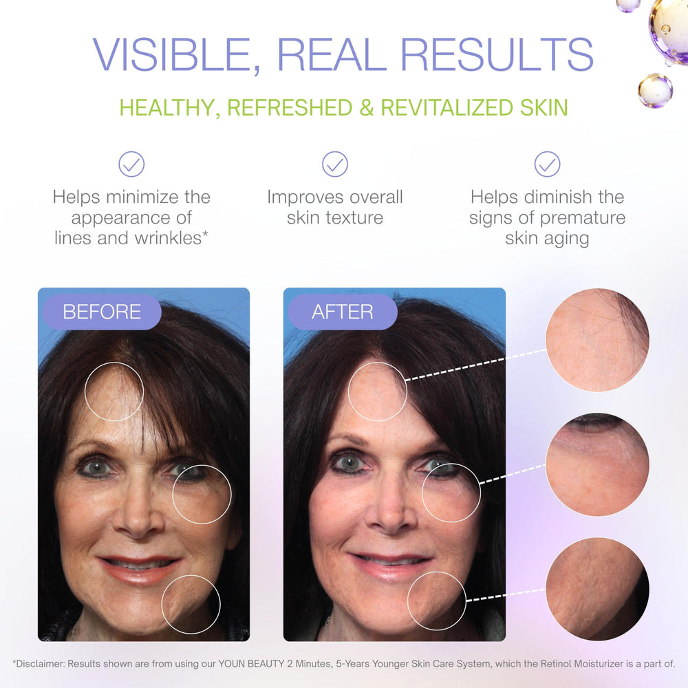 Avec YOUN Beauty, effet éclat au réveil.