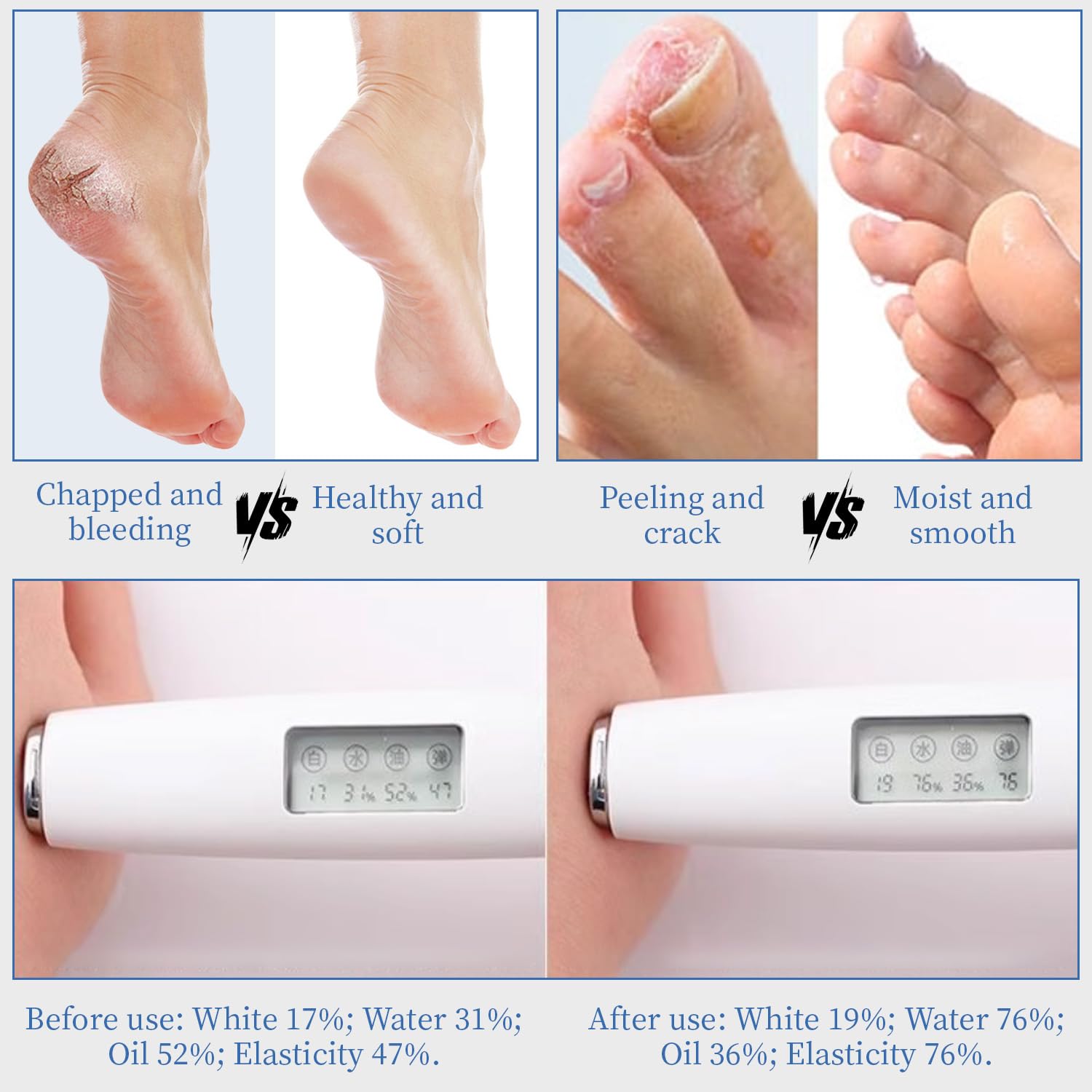 Application et massage de la crème YOUNGYOUNGLOVE pour favoriser l'absorption.