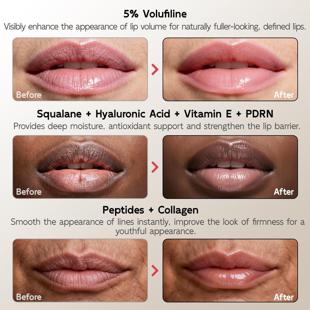YouthVibe lèvres hydratées grâce au squalane et à l'acide hyaluronique.