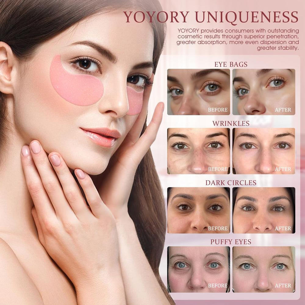 YOYORY eye patch placed on eye demonstrates a cooling, soothing effect