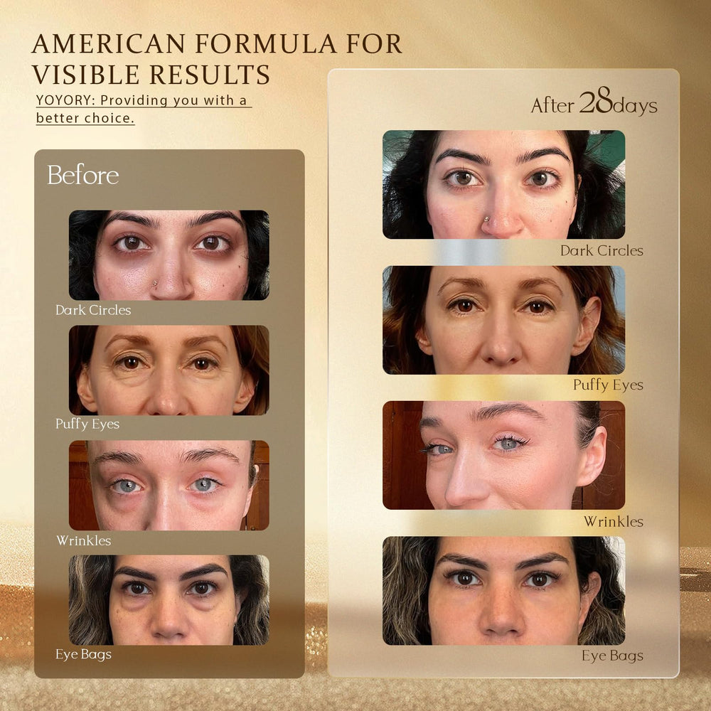 YOYORY Peptide Technologie Yeux – effet tenseur et revitalisant.