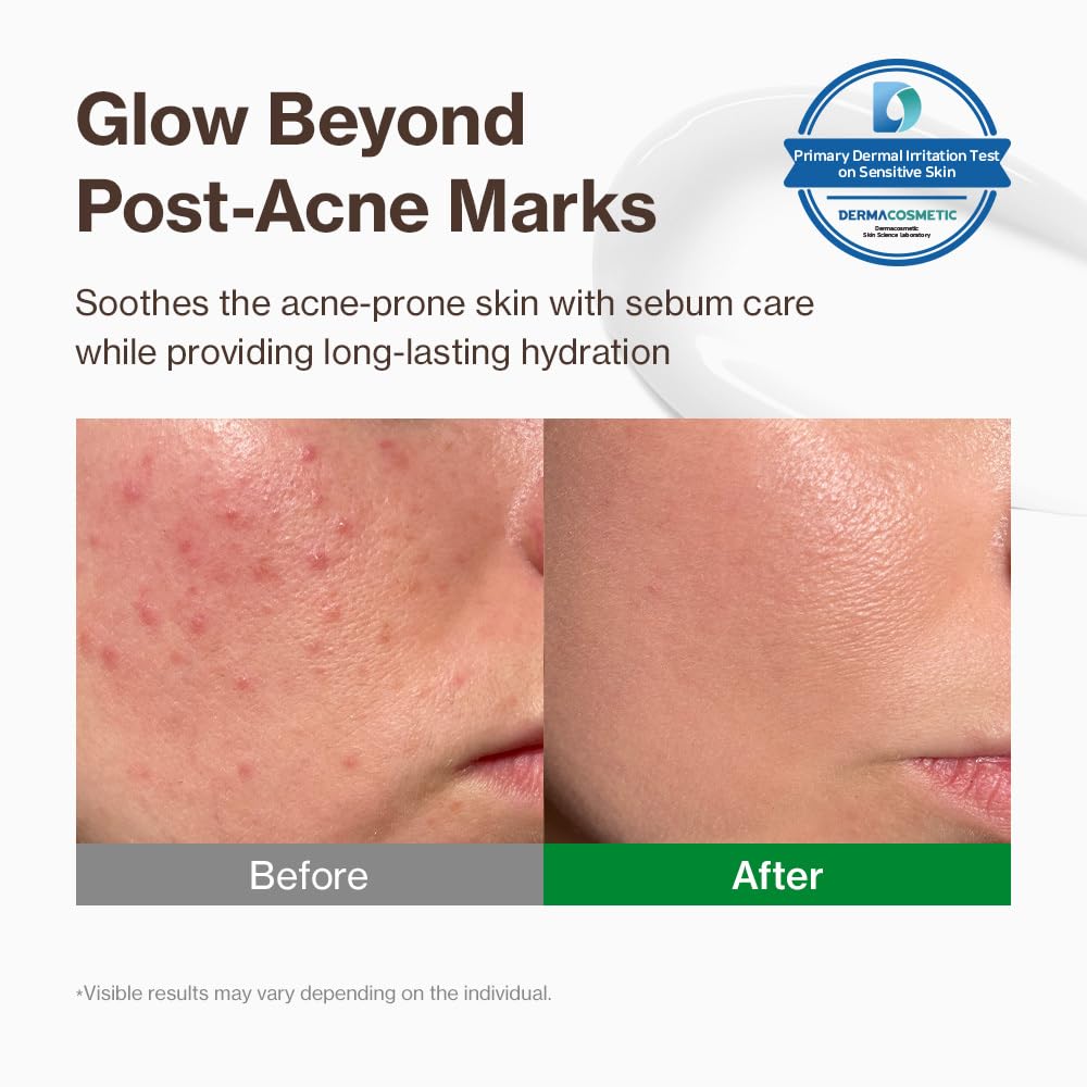Application de la crème YUMU Cica Exosome sur peau sensible, sensation de fraîcheur.