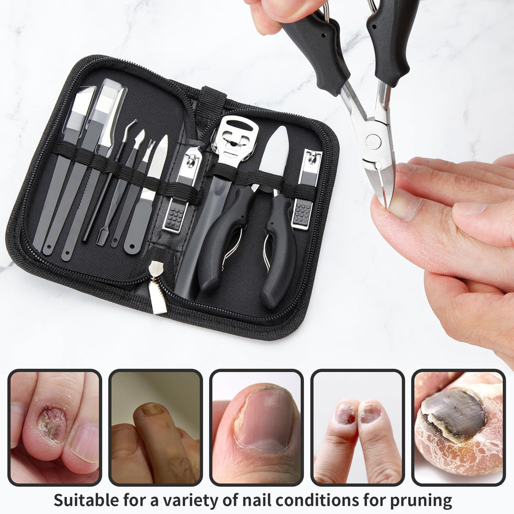 YWEAUIV Couteau oblique pour atteindre le pli de l'ongle incarné en douceur.