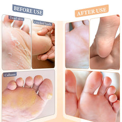Avant et après avec Z：SEA - pieds plus lisses et hydratés