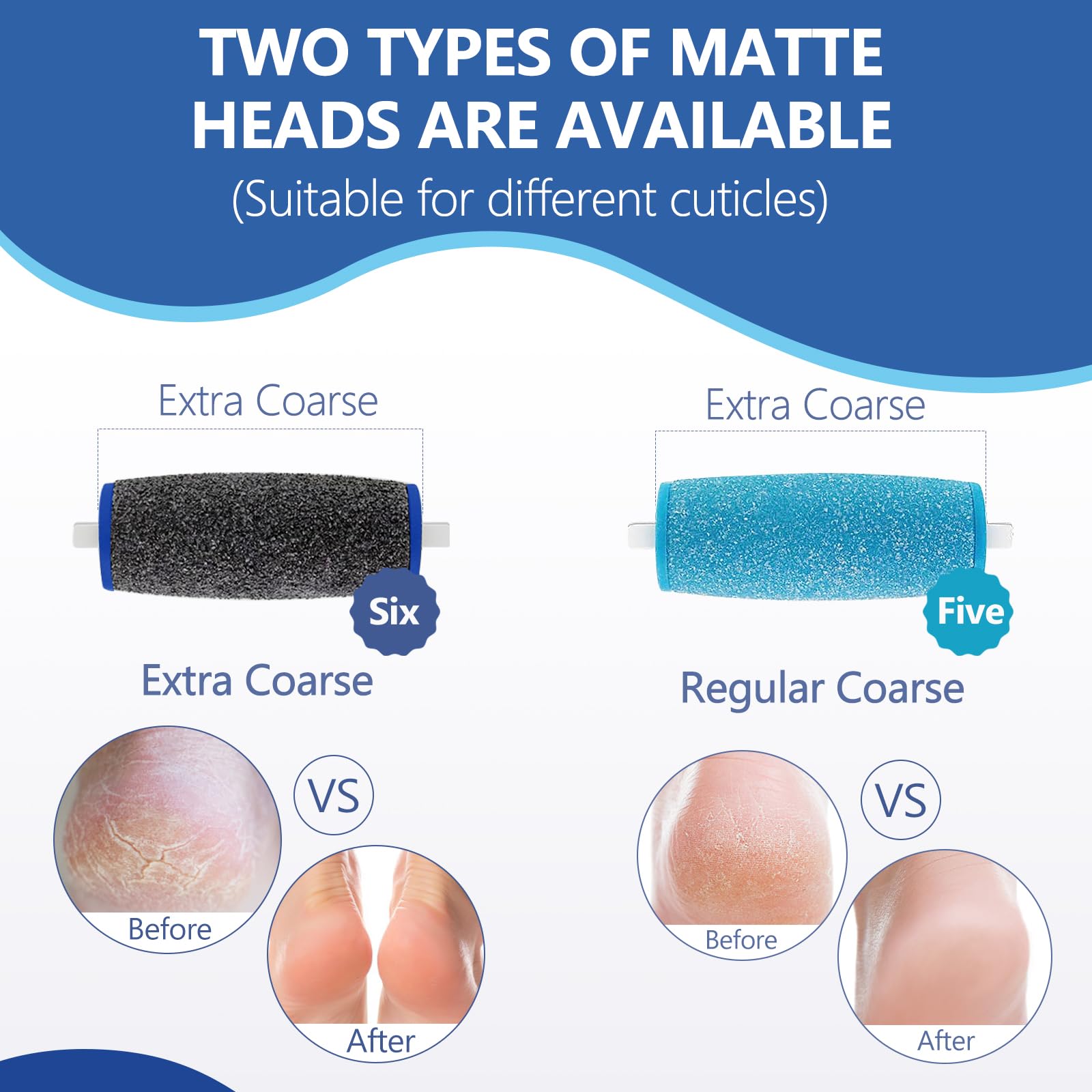 Rouleaux rugueux réguliers Zaboul pour Amop Pedi Perfect, peau lisse après usage.