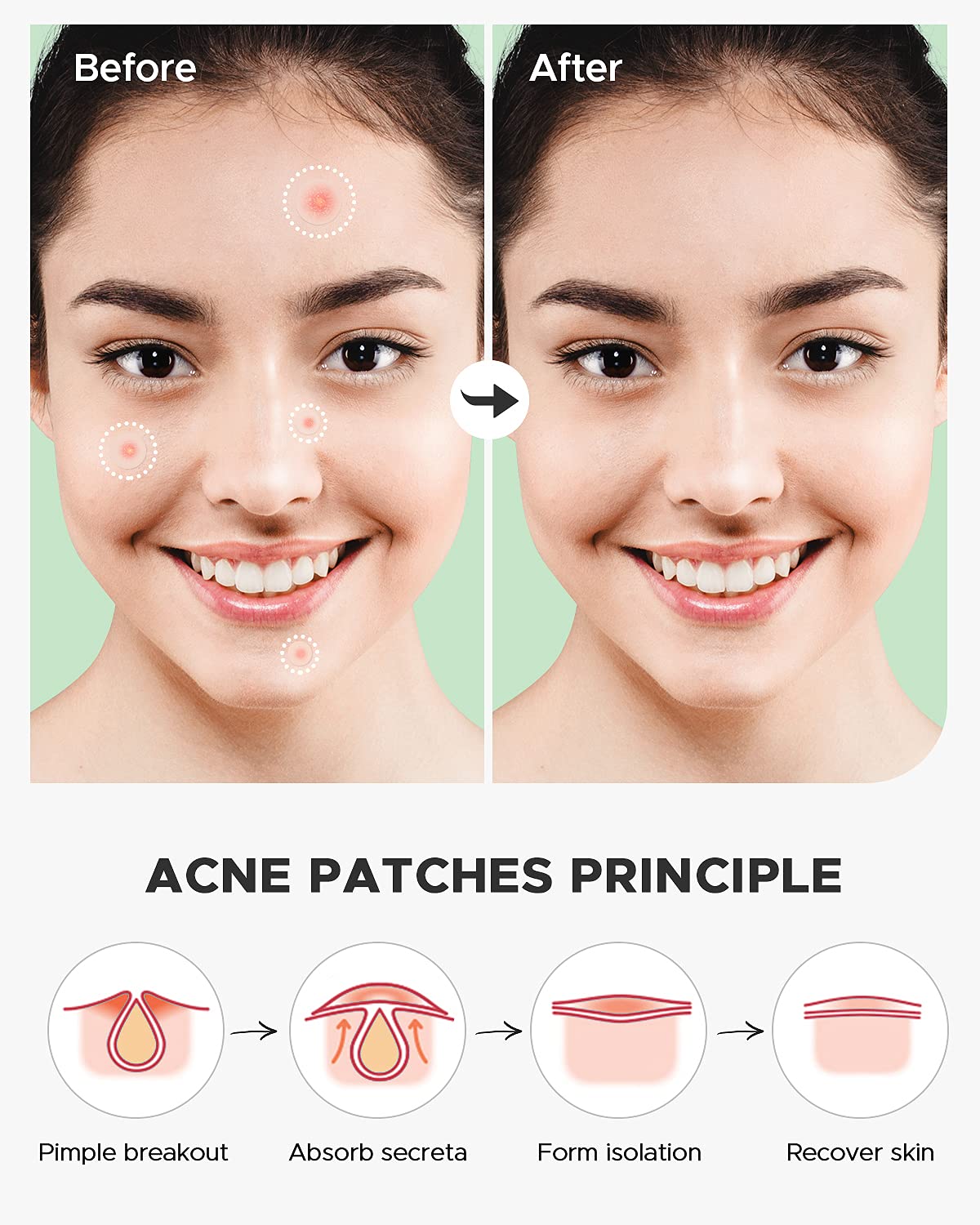 Patch hydrocolloïde ZATKTK 14 mm, options polyvalentes.