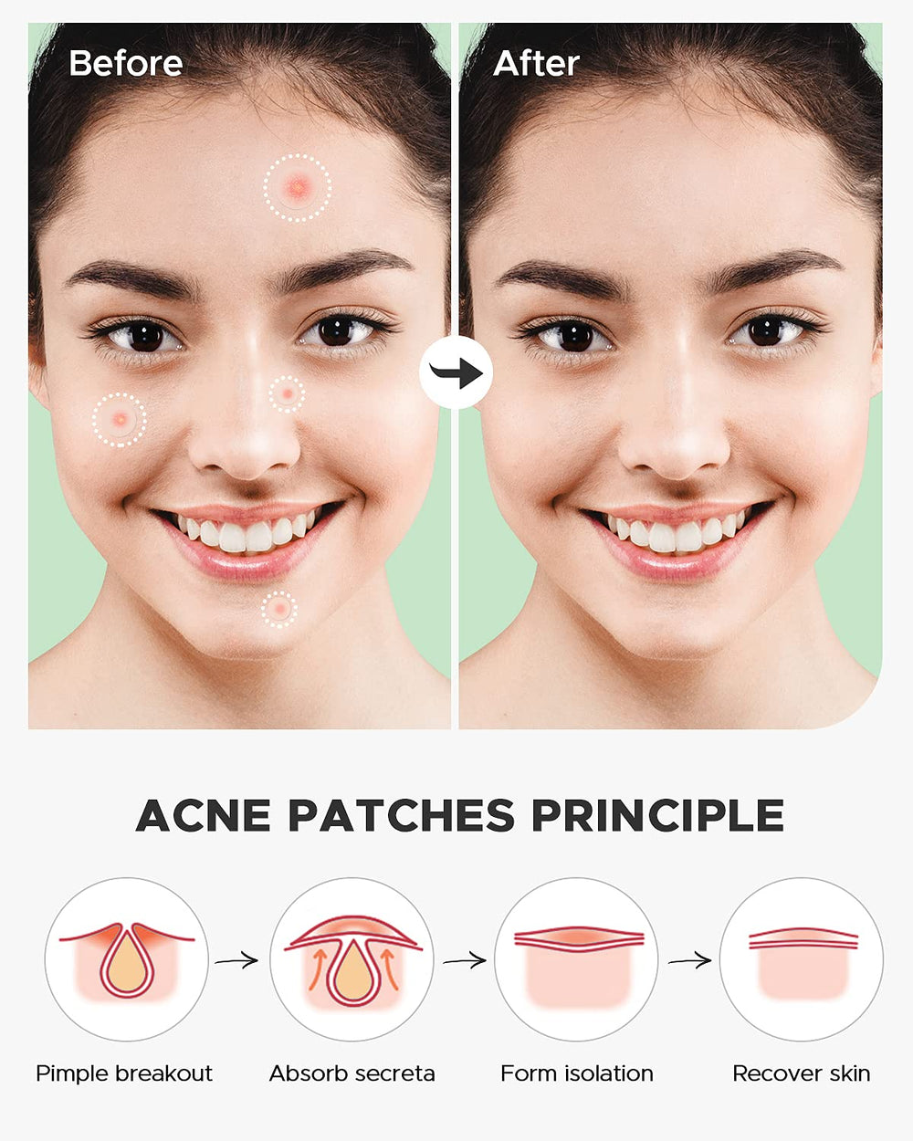 Patch hydrocolloïde ZATKTK 14 mm, options polyvalentes.