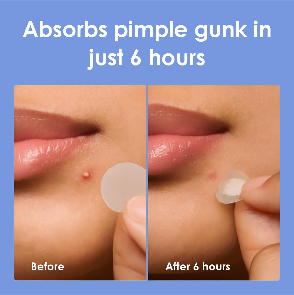 Pansement hydrocolloïde ZELIER Visage – étui portable et écologique.