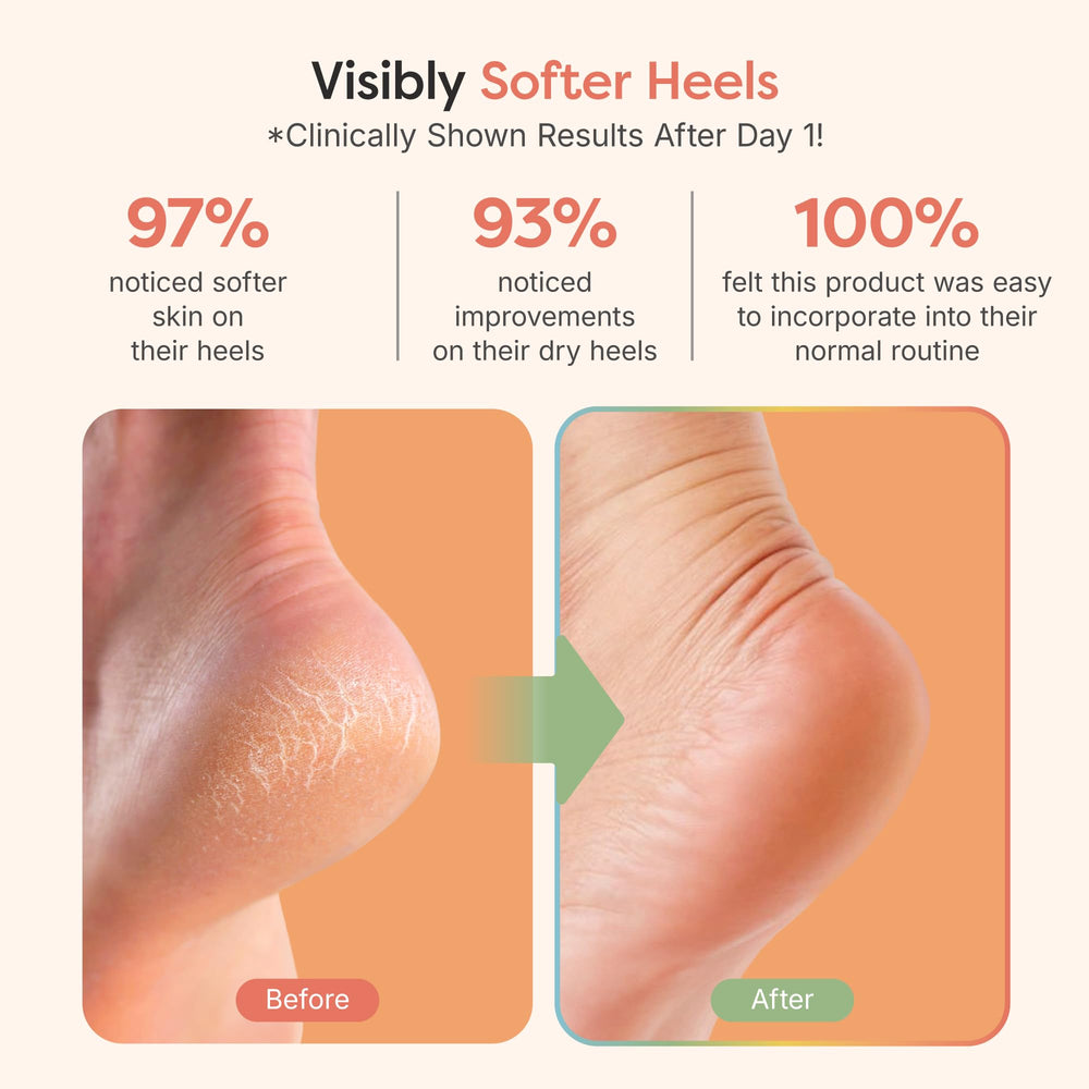 Embllage cadeau ZenToes prêt à offrir pour le soin des pieds.