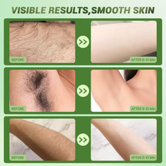 Zeponyx crème dépilatoire, épilation en 10 minutes sur zones sensibles.