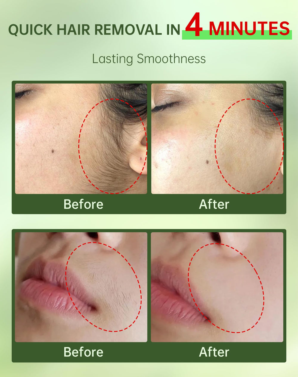 Zeponyx crème dépilatoire visage, texture onctueuse adaptée peaux sensibles.