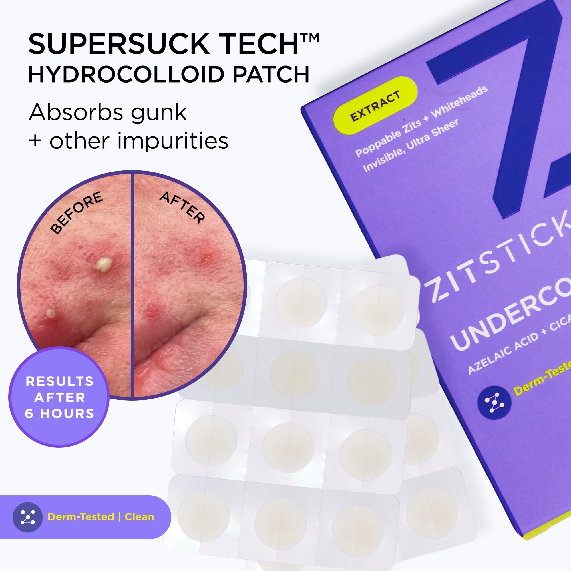 Application sans contact ZitSticka pour une hygiène améliorée et sûre.