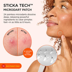 Patch ZitSticka Killa mini pour application rapide et discrète