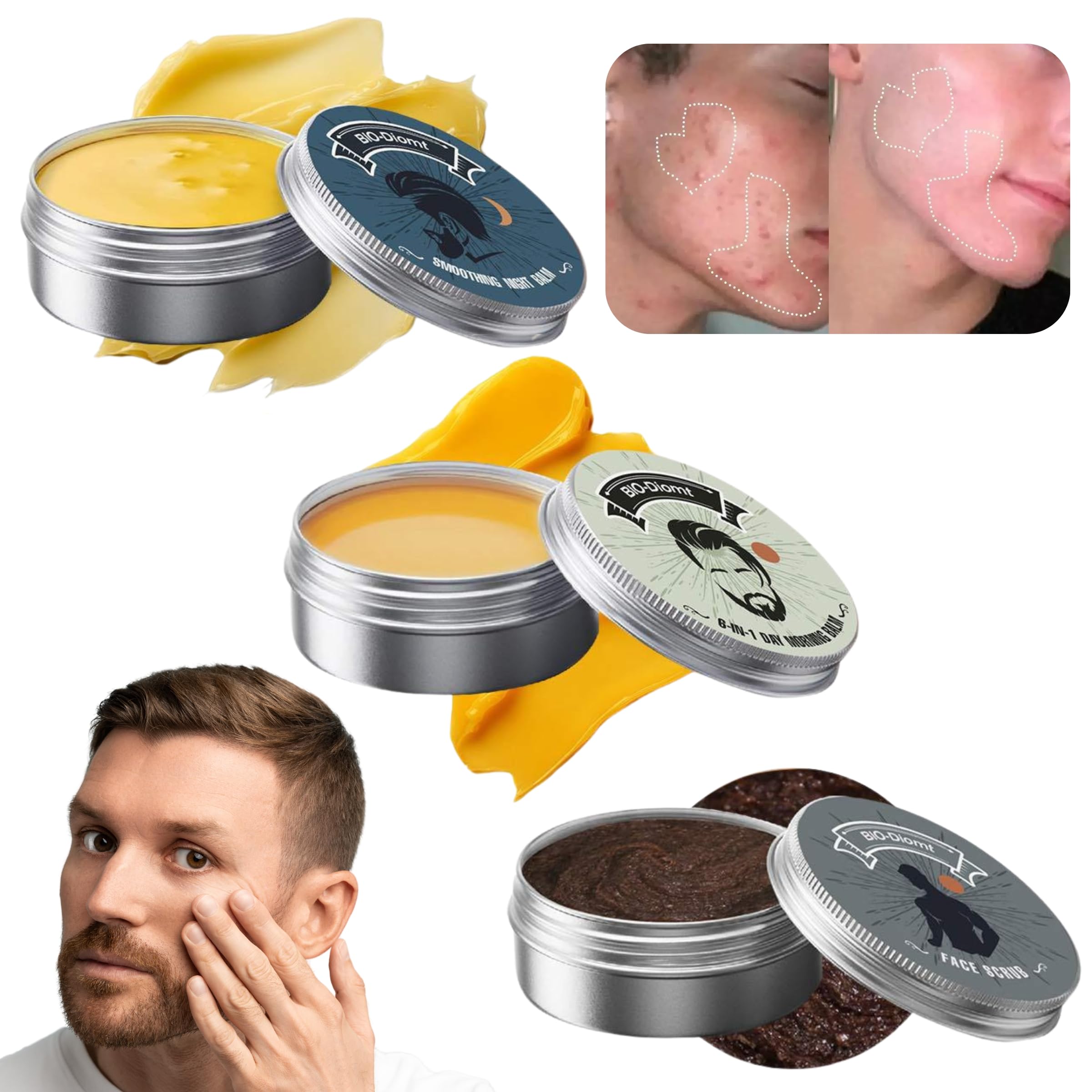 ZLSJJCLMZ Baume bio pour acne, soin ciblé et purifiant.