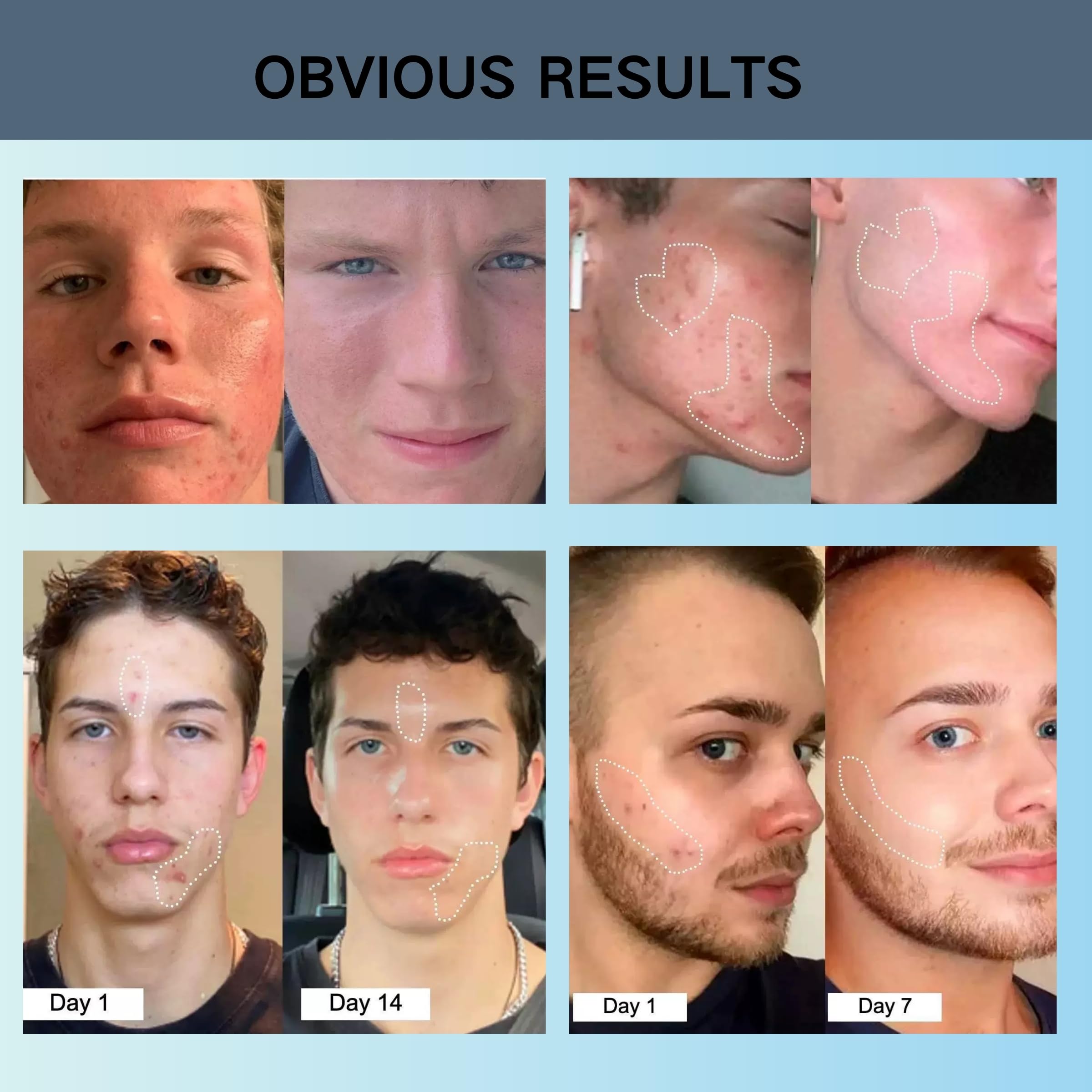 Peau adaptée à tous types grâce à ZLSJJCLMZ.
