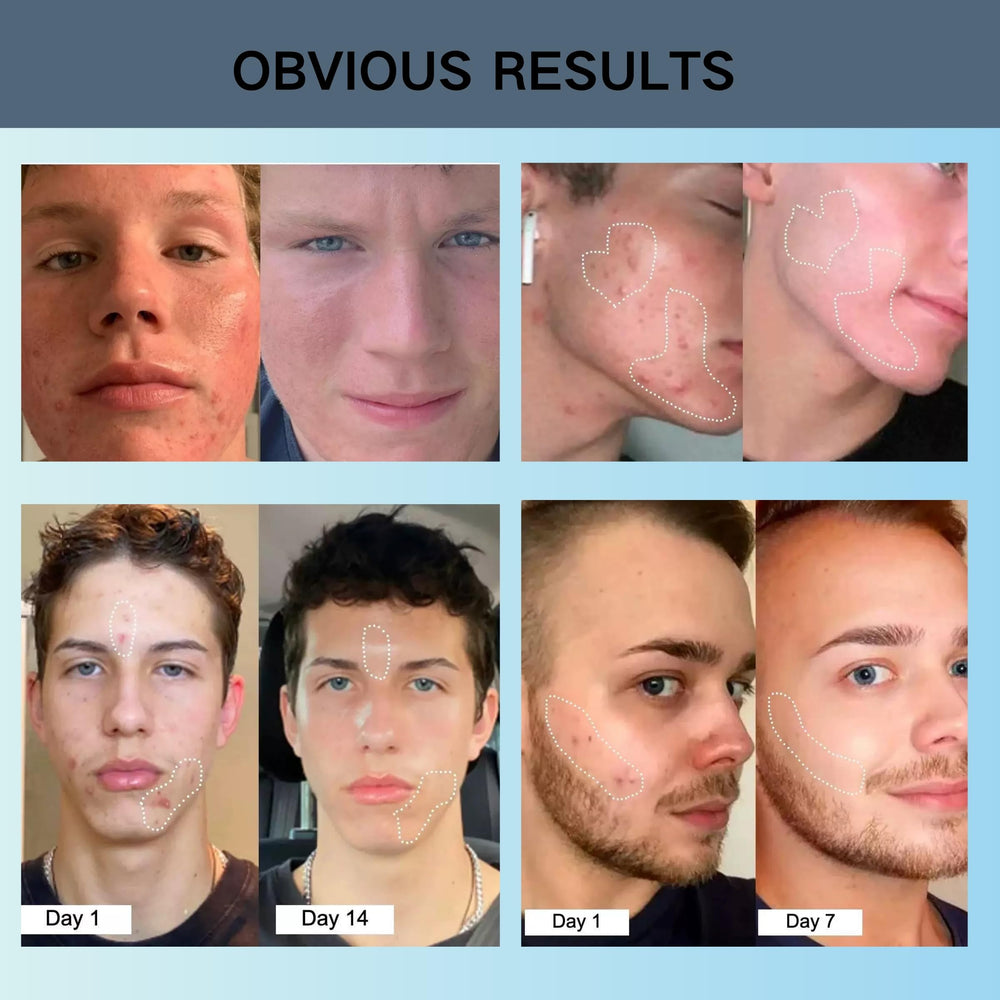 Peau adaptée à tous types grâce à ZLSJJCLMZ.